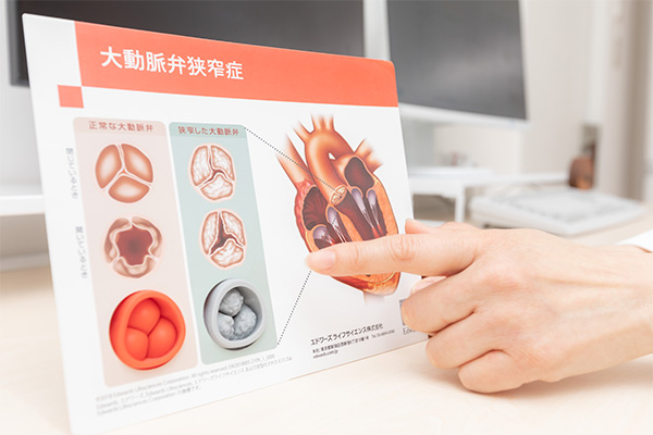 「頑張りすぎない工夫」で続けられる健康づくりを
